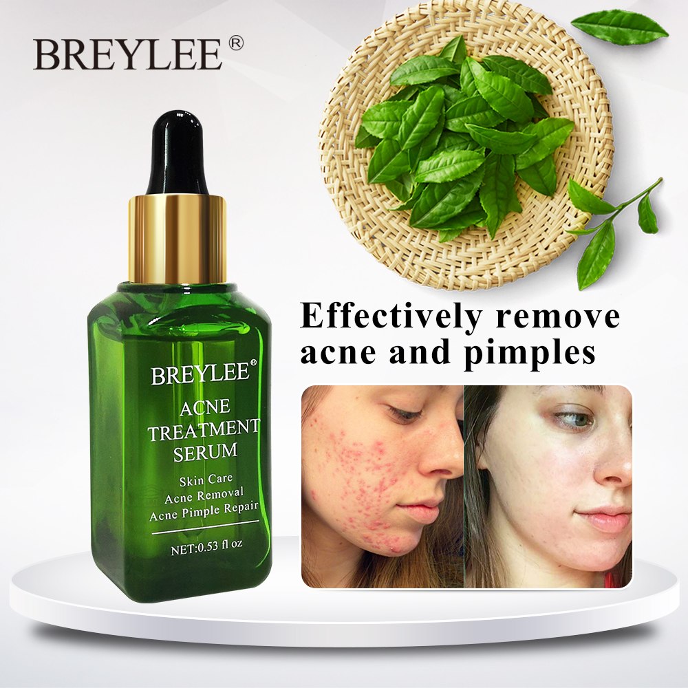 Anti Acne Gel Serum for Pimples & Acne Scars | BREYLEE (15ml)