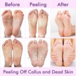 Before and after results of foot peel mask showing smooth soft feet